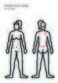 Eczema mapping-01.jpg